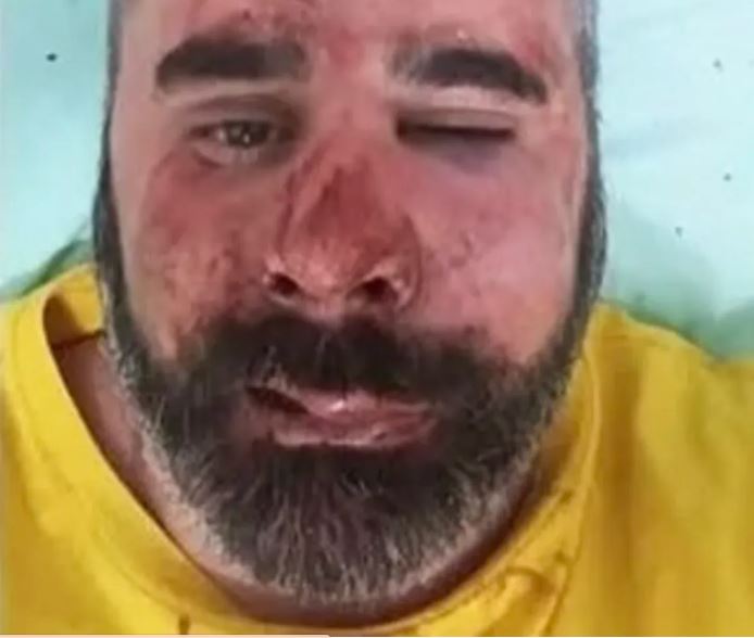 Violento ataque en San José: el presidente de La Libertad Avanza recibió una brutal paliza
