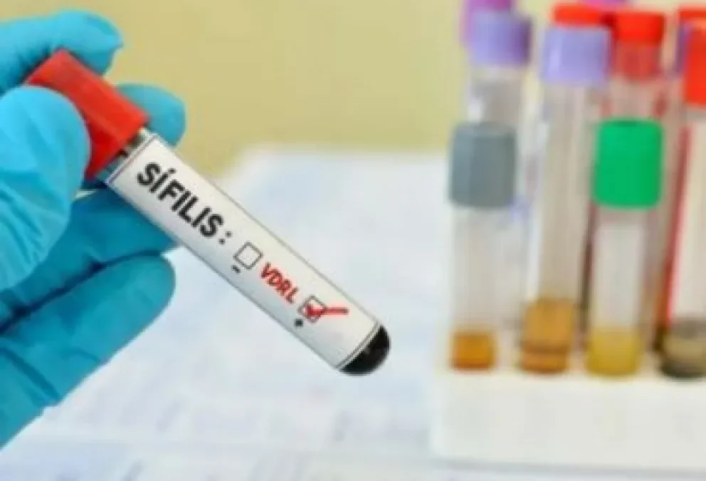 Sífilis en Entre Ríos: La tasa de notificación aumentó un 72% en 2025, superando el promedio nacional
