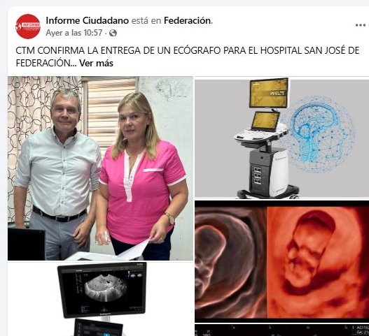 LA DIRECTORA DEL HOSPITAL SAN JOSÉ SALIÓ A DESMENTIR SUPUESTAS GESTIONES DE GALIMBERTI PARA CONSEGUIR EL ECÓGRAFO