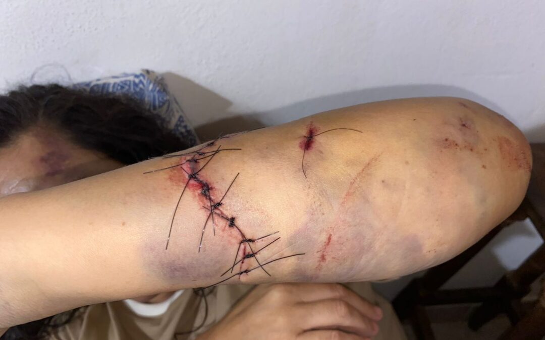 Preocupa el estado de salud de la mujer atacada por su excuñado con un hacha