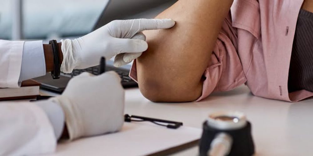 AFELC ofrecerá controles dermatológicos gratuitos